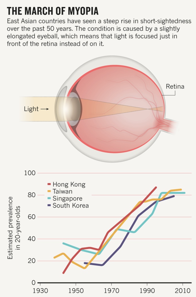Rövidlátás, Myopia, fénytörési betegség - Budai Egészségközpont
